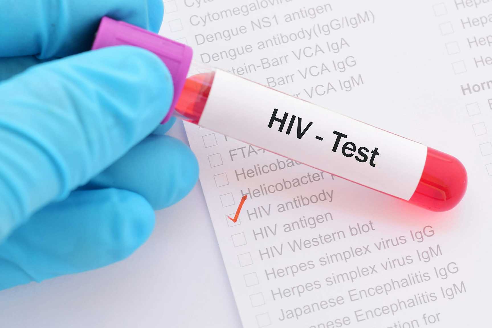 HIV Testing Image 3